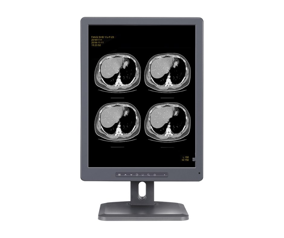 ktc-technology-orvosi-monitor-medipixel